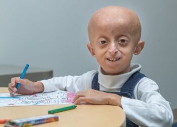 Hiç Duymadığınız İlginç Hastalıklar